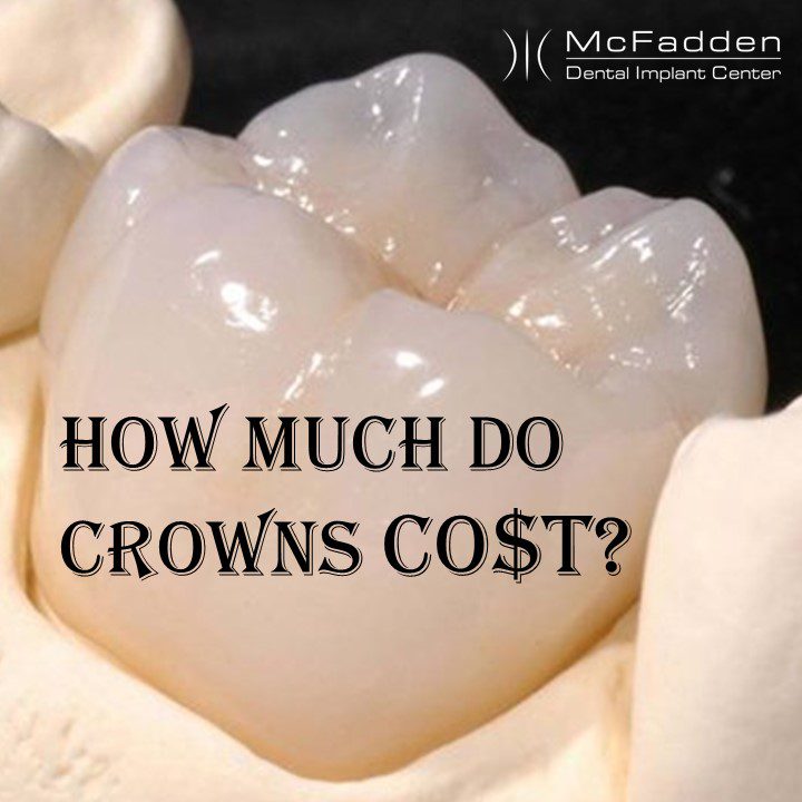HOW MUCH DO CROWNS COST Dental Implant Center