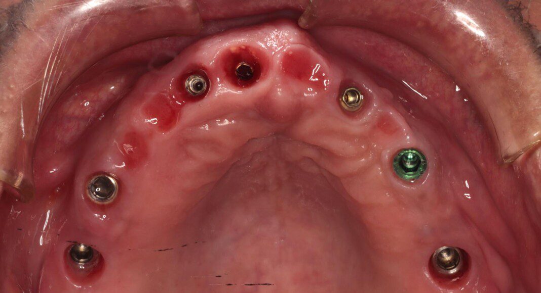 Beautiful soft tissue development.