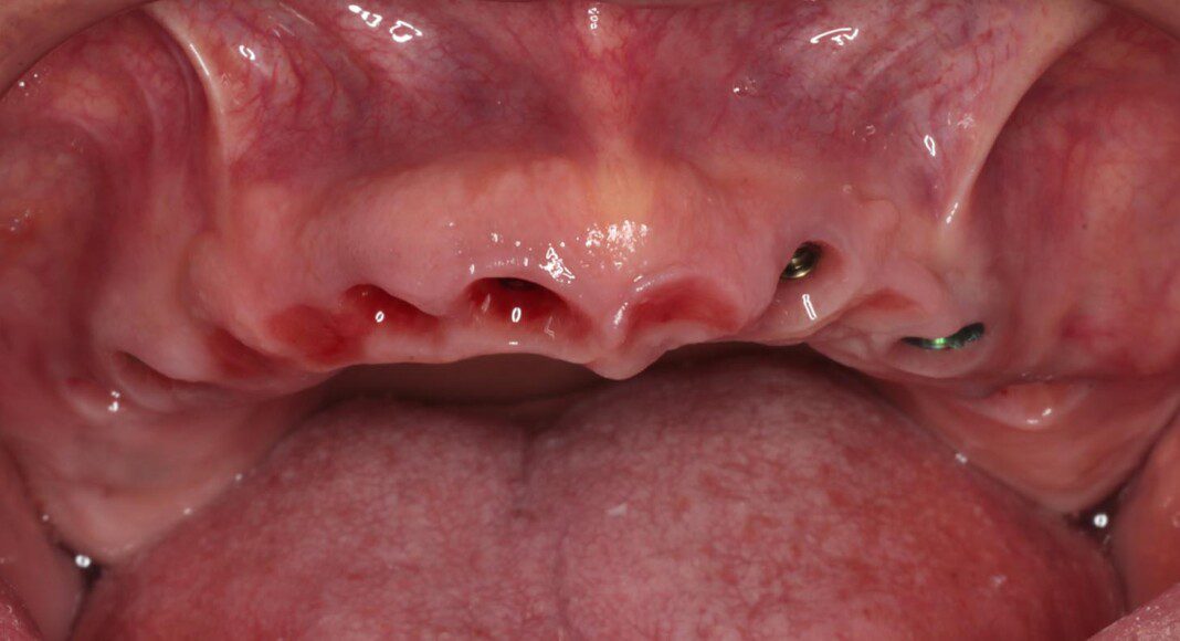 Beautiful soft tissue development.