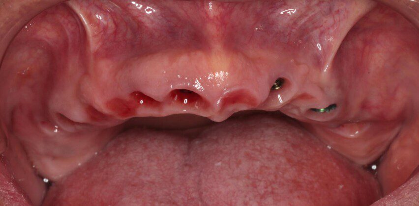Beautiful soft tissue development.