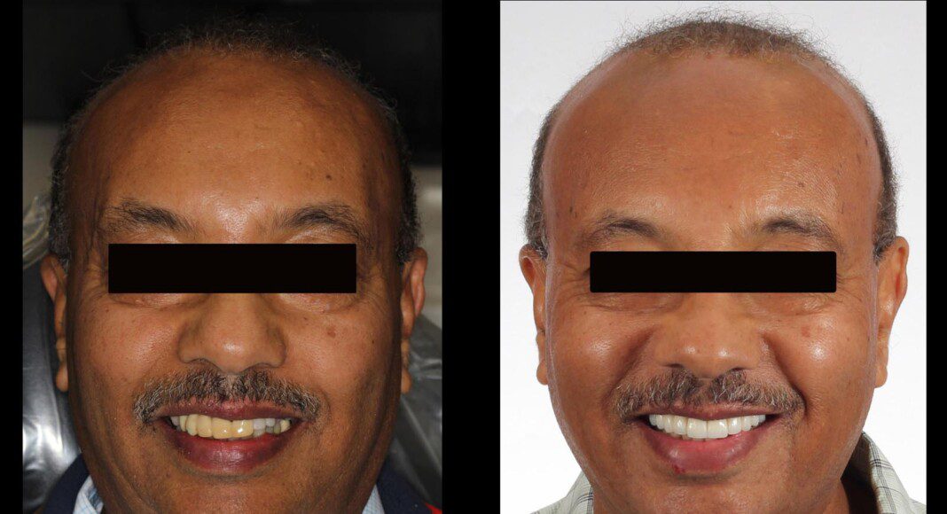 Before and after. WOW!