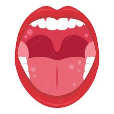 "Ways medications can harm your teeth, mouth ulcerations, painful soft tissue lesions"