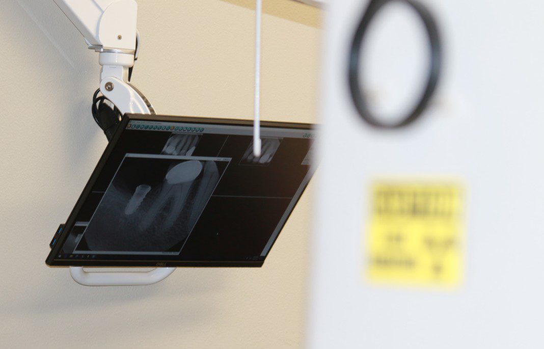 Are Dental XRays Safe? Dental Implant Center