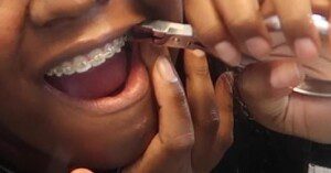 Girl taking braces off