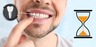 man showing implanted teeth with an hourglass icon