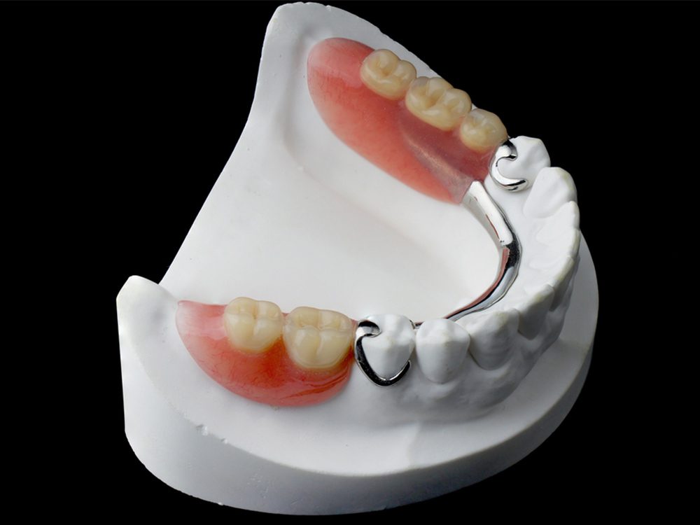 Lower Partial Dentures Dental Implant Center
