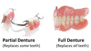 “Procedures done by prosthodontists, dentures and partials"
