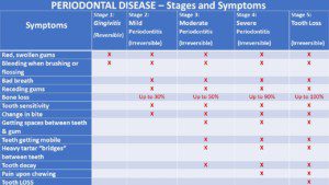 "Gum disease, 5 stages of, chart of symptoms for each stage as it progresses"