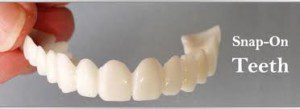 "Dangers of DIY dental treatment, snap-on-teeth"