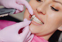 What Is The Difference Between Veneers And Implants?