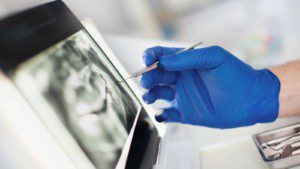 "What to expect when getting dental implants, xrays, exam"