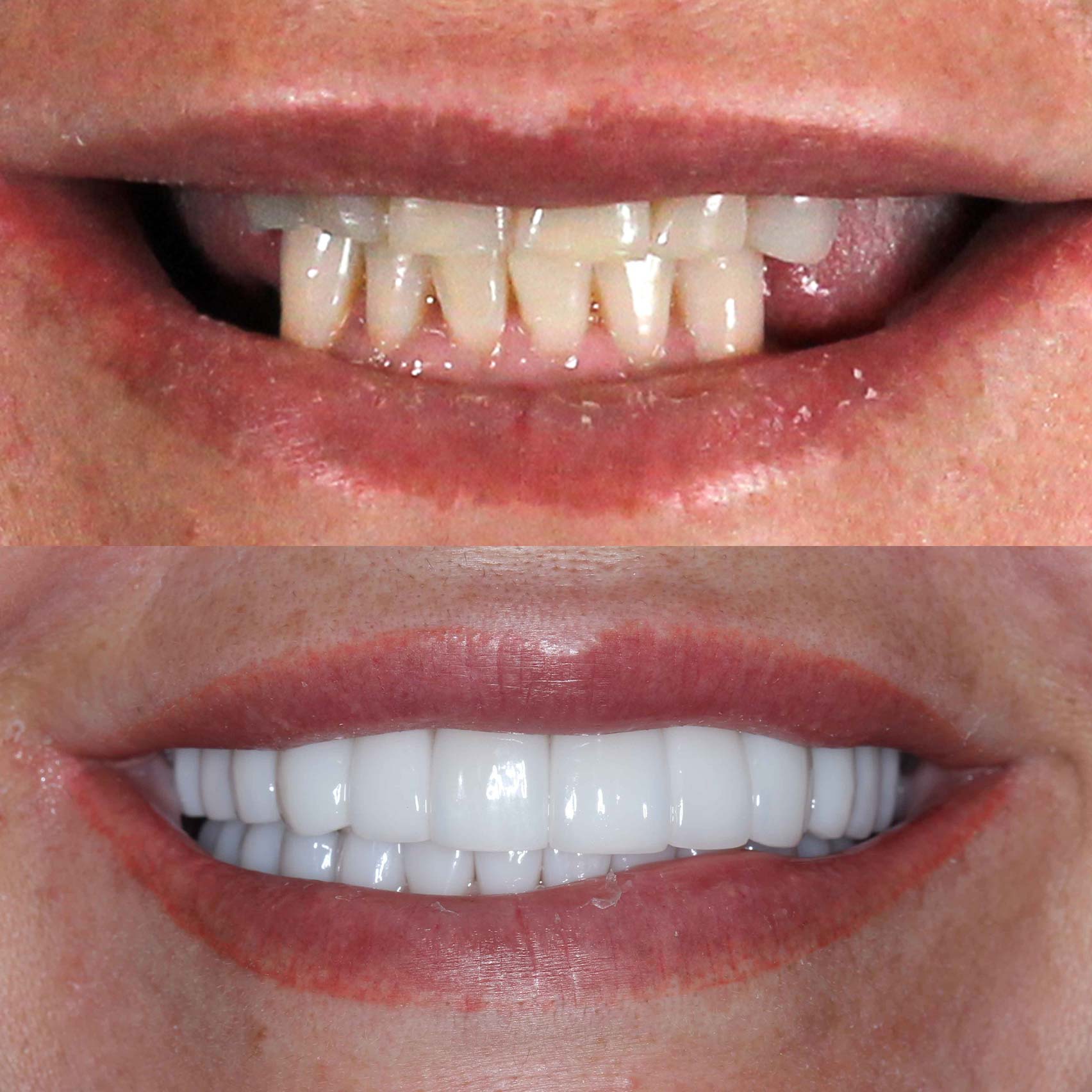 before after before after
