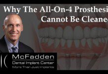 Why All-On-4 Prosthesis Cannot Be Cleaned