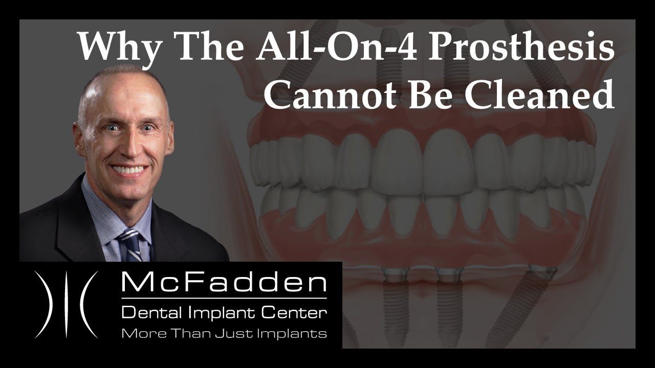 Why All-On-4 Prosthesis Cannot Be Cleaned