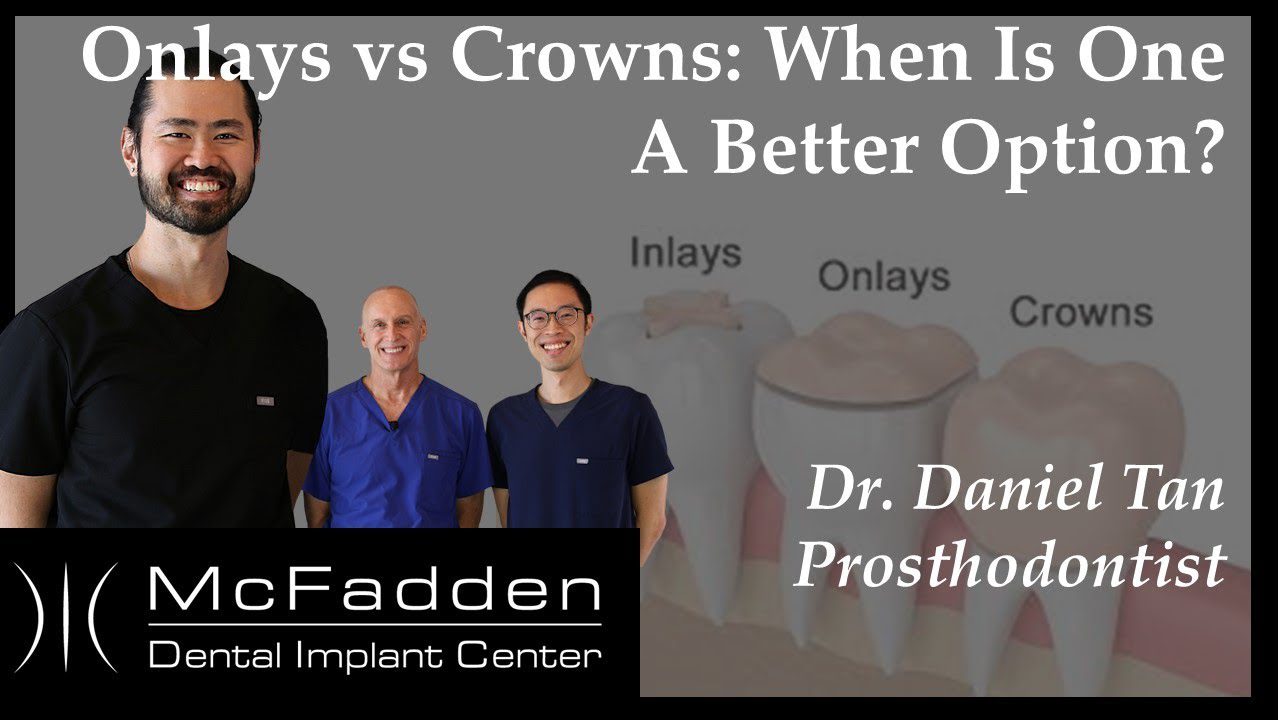 Inlays, Onlays and Crowns: When and Why One Might Be a Better Option