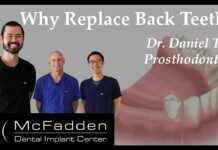 Why Replace Back Teeth?