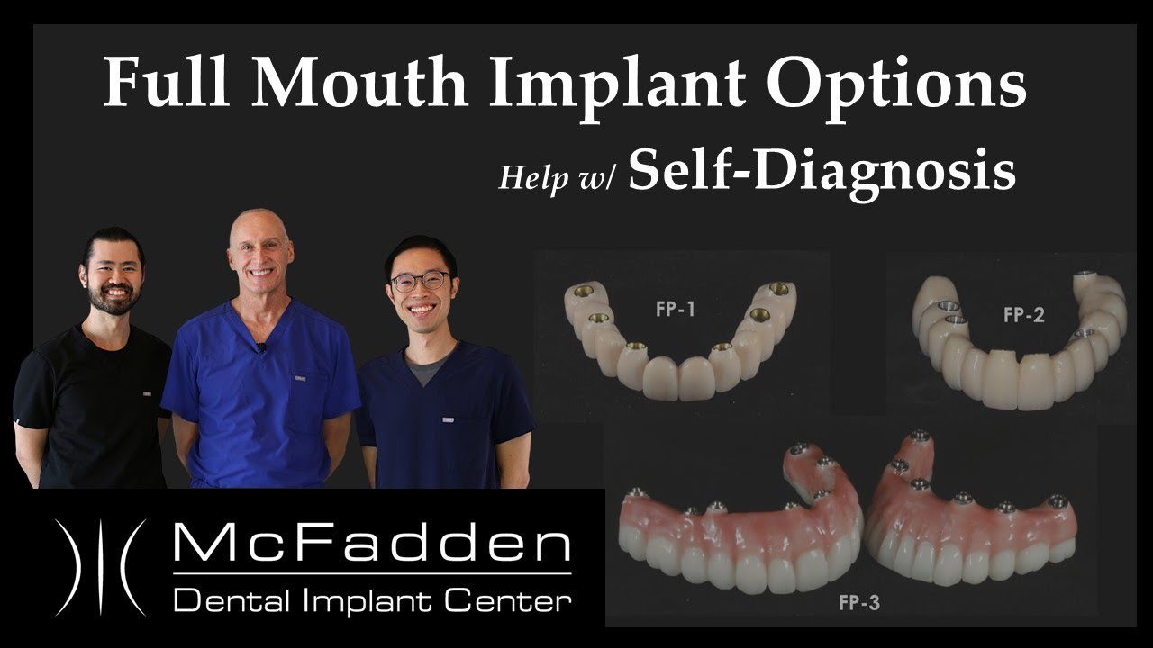 Full Mouth Implant Options/Help with Self-Diagnosing Which You Qualify For