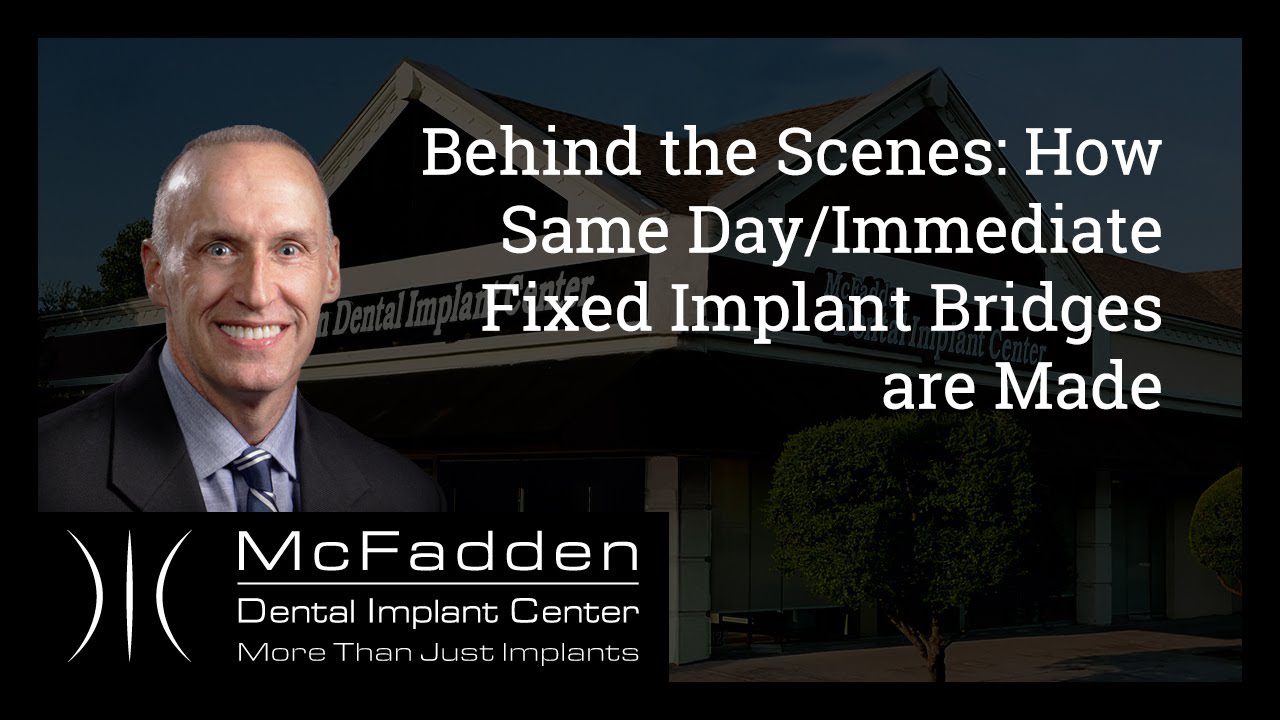 Behind the Scenes: How Same Day/Immediate Fixed Implant Bridges are Made