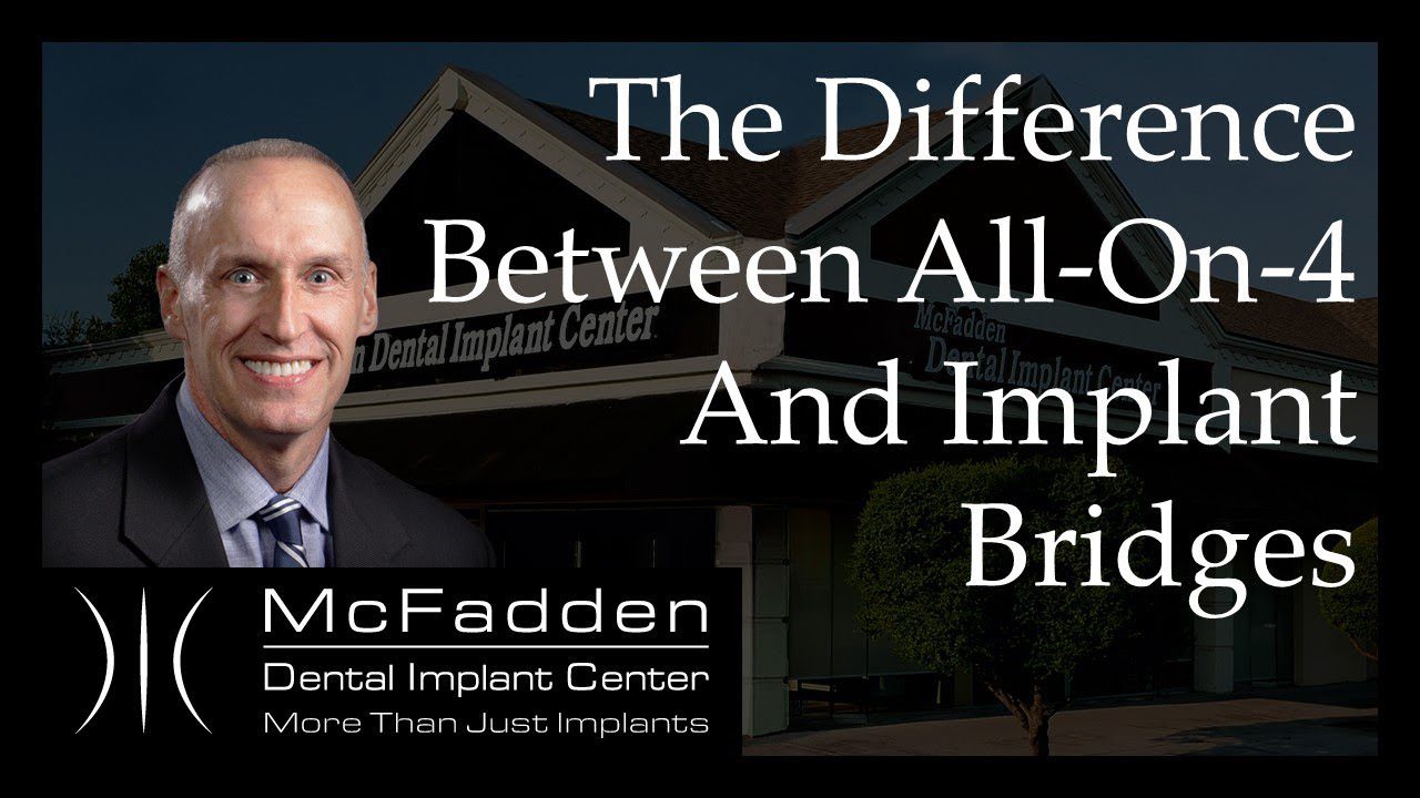 The Difference Between All-On-4 and Implant Bridges