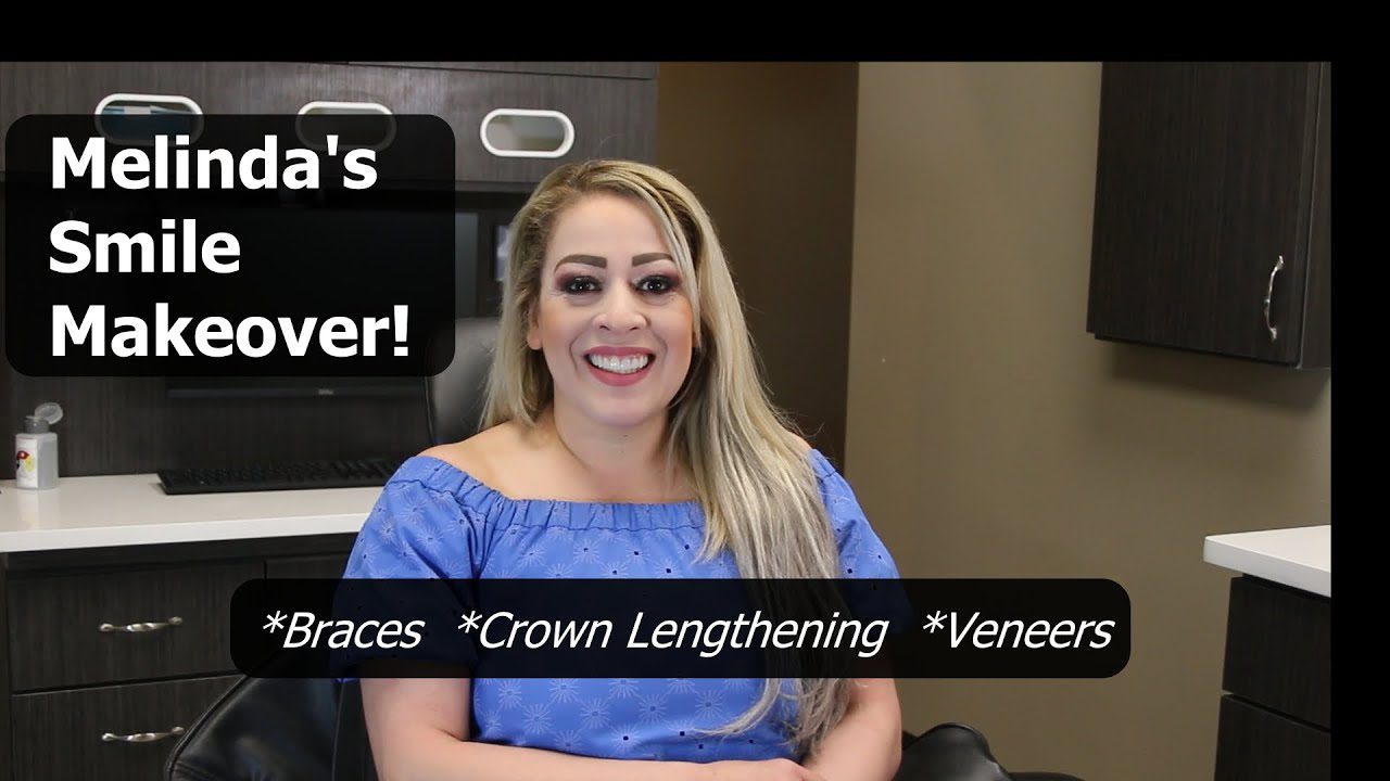 Melinda S Smile Makeover Braces Crown Lengthening And Veneers Melinda S Smile Makeover Braces Crown Lengthening And Veneers