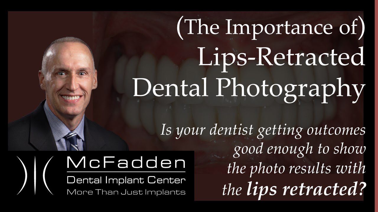(The Importance of) Lips-Retracted Dental Photography