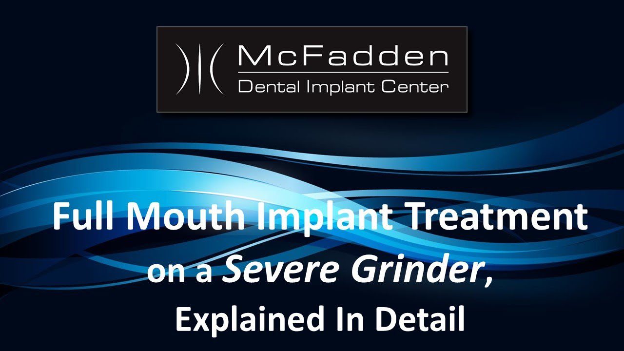 Full Mouth Implant Treatment on a Severe Grinder Explained, In Detail