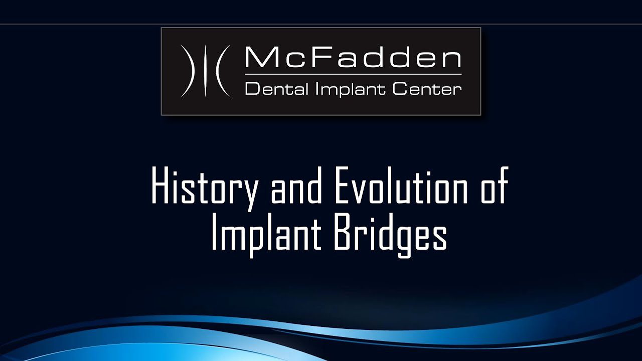 History and Evolution of Implant Bridges