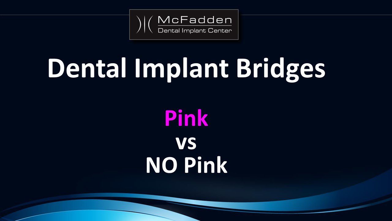 Dental Implant Bridges: Pink or NO Pink?