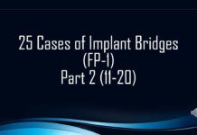 25 Amazing Dental Implant Bridge Cases (Part 2)