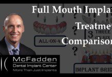 Full Mouth Implant Treatment Comparisons