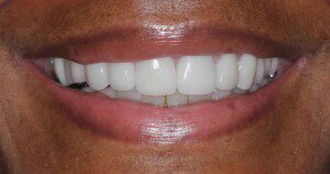 smile