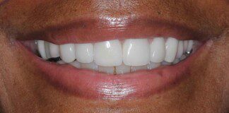 smile