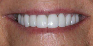 smile