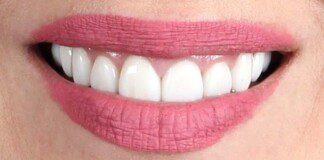 smile