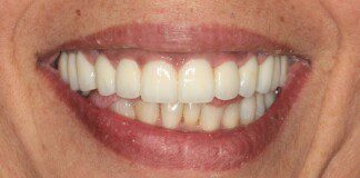 smile